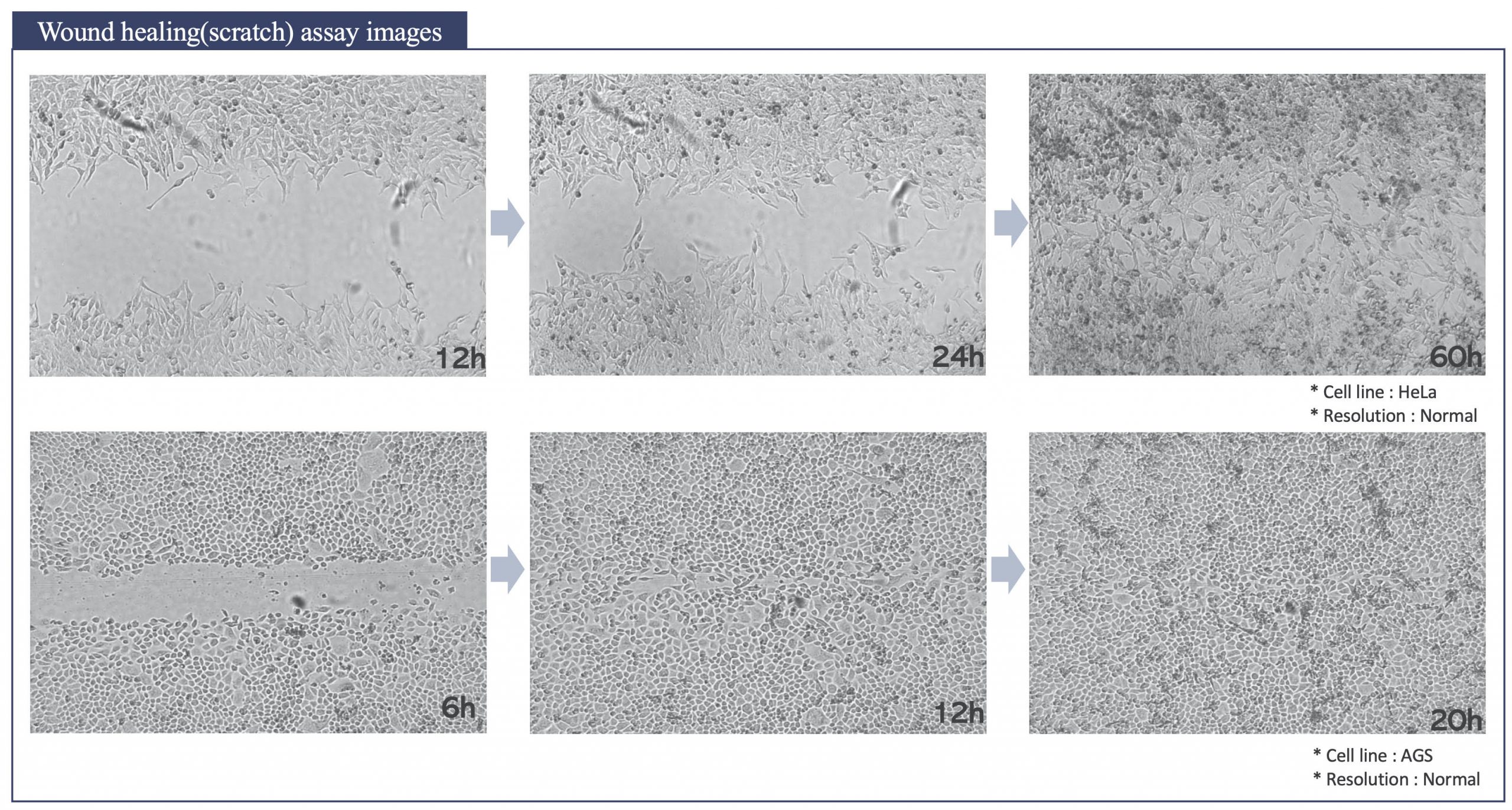 Images de scratch test ou wound healing par le CELLOGER Mini IZIBIO sur cellule AGS et HeLa